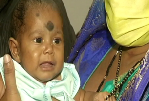 Odisha Newborn's 'True Human Tail' Surgically Removed in World's First Case